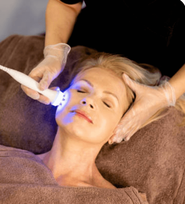 Derma Pen (Microneedling)